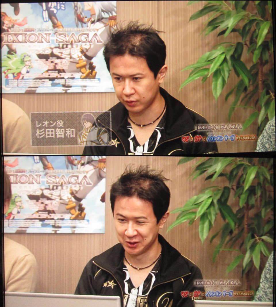 朗報 杉田智和さん 髪が復活する ひまつぶし 朗報 杉田智和さん 髪が復活する ひまつぶし