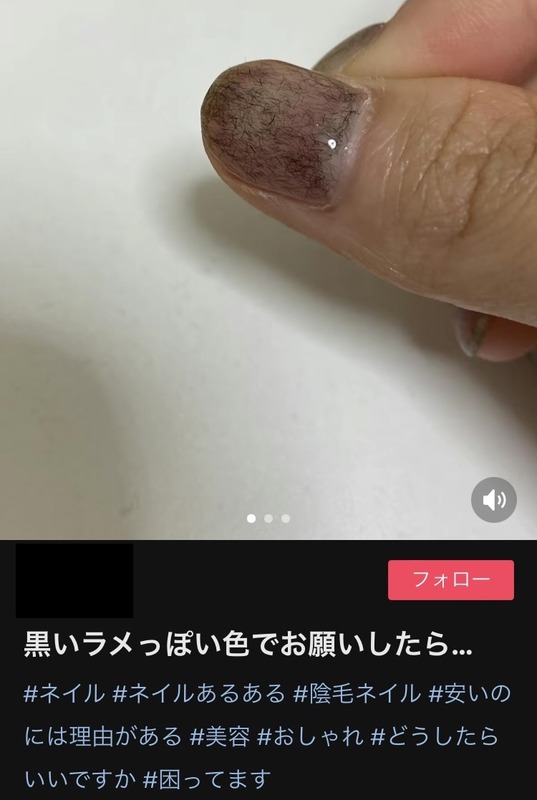 【画像あり】女さん、ネイルサロンで爪にチ◯毛をふりかけられてしまうｗｗｗｗｗｗｗｗ