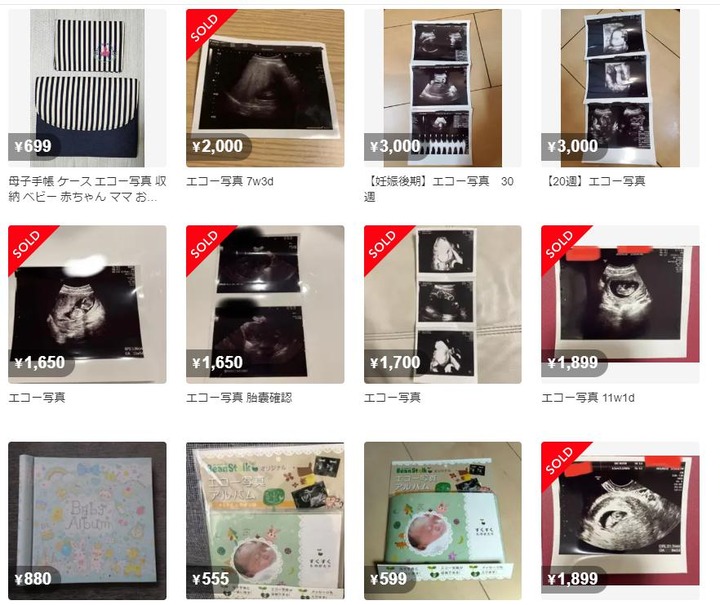 【悲報】メルカリ、「胎児のエコー写真」が売られていることが判明ｗｗｗｗｗｗｗｗｗｗ