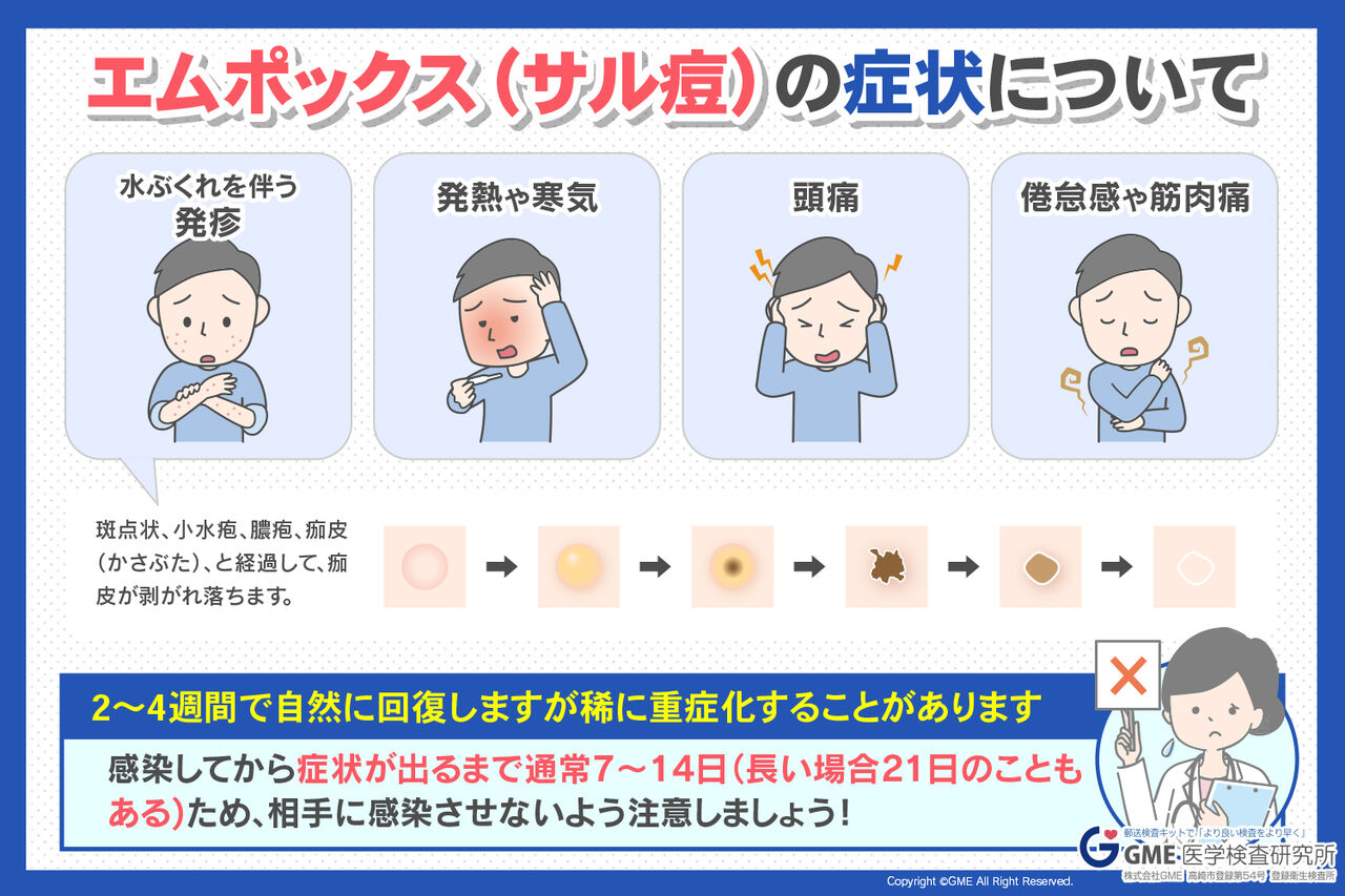 【サル痘】エムポックス鹿児島県内初確認!九州・沖…多くは男性間の性的接触 国内188人確認 : にほんのニュース