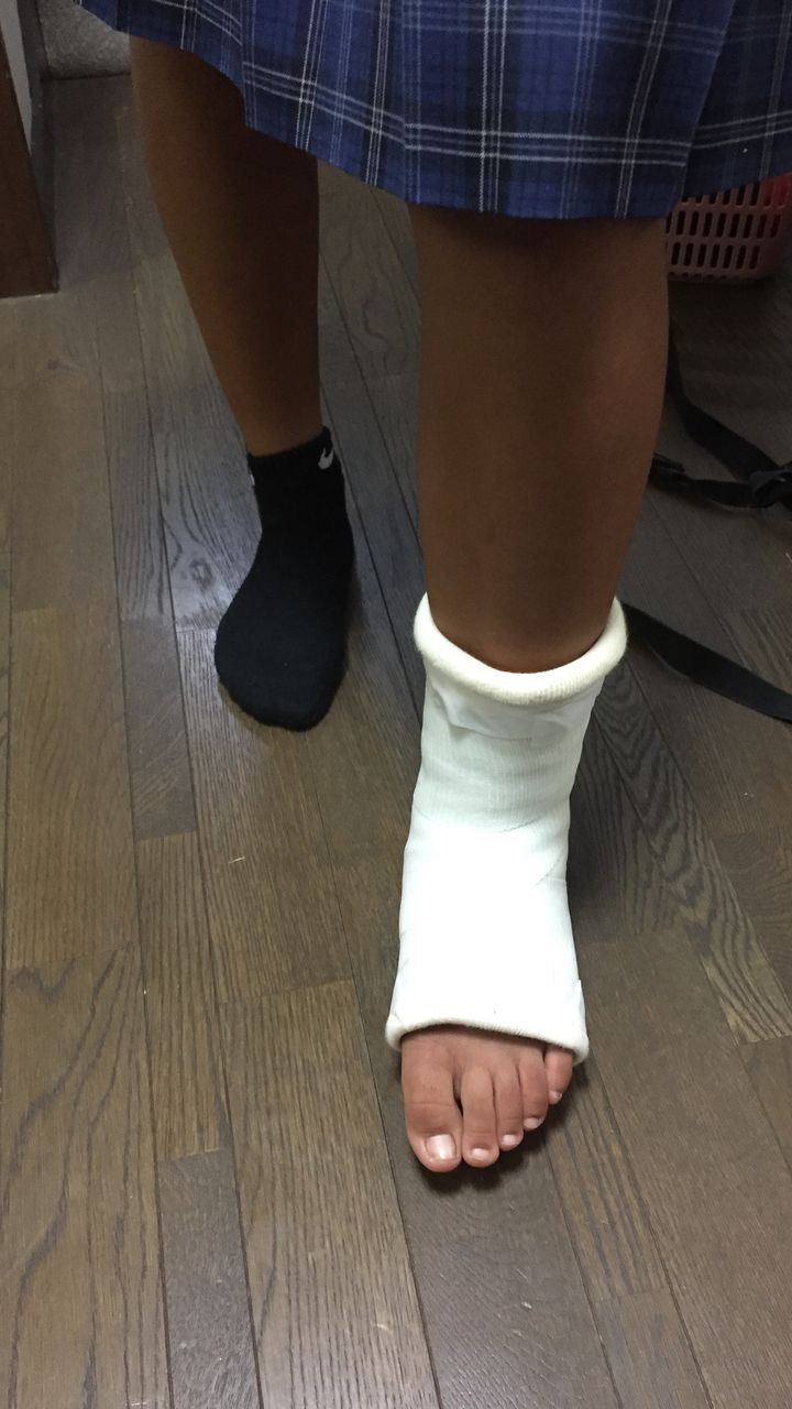 娘 足関節靭帯断裂 いつも笑っていたい