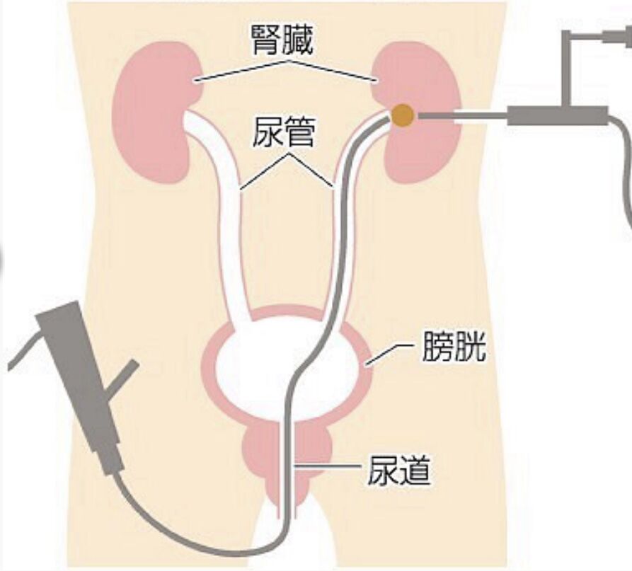 低侵襲 産業医科大学 医学部 泌尿器科学講座
