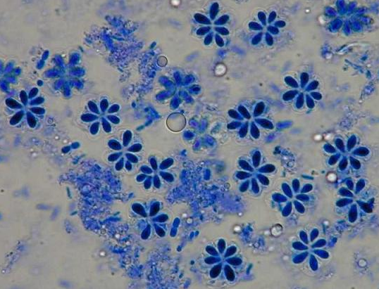 魚の寄生虫 クアド菌 アニサキスにご注意を The Firstone 魚の寄生虫 クアド菌 アニサキスにご注意を The Firstone