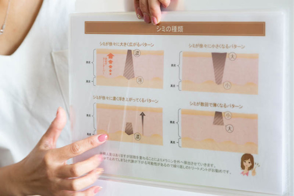 アンズ-19090425