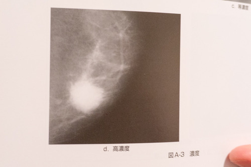 くずは画像診断-437