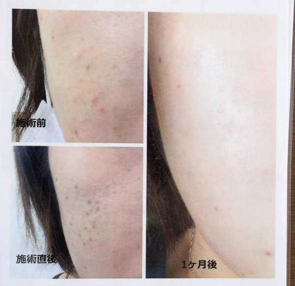 アンズ-19090469