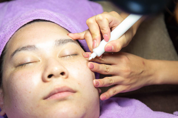 アンズ-19090460