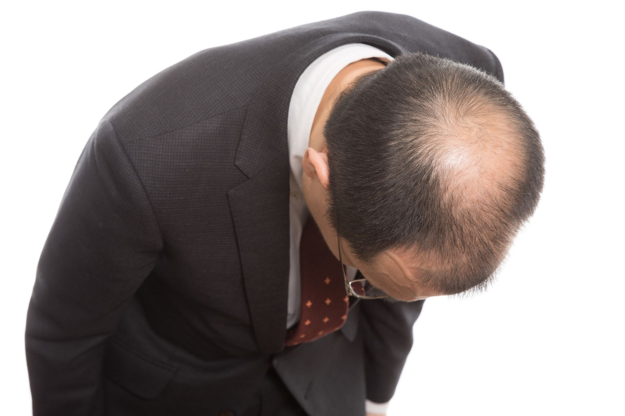 ウィル aga クリニック