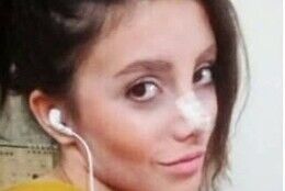 アンジェリーナ・ジョリーに憧れた女の整形