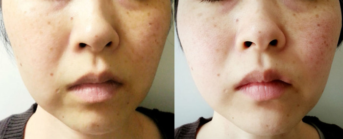 Facial Fitness Pao フェイシャルフィットネス パオ を使ってみた 第3回目レポ のんびりかめ子の休日