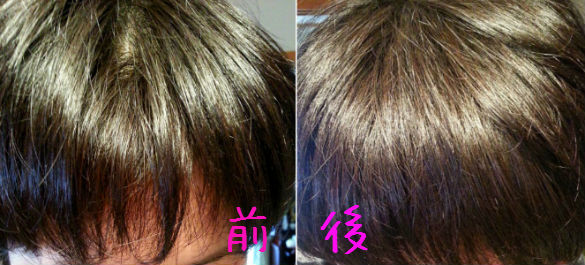 ウテナ ゆず油 無添加ヘアマスクを試してみた ひんやり じんわりの今までにない贅沢トリートメントスパ体験 のんびりかめ子の休日