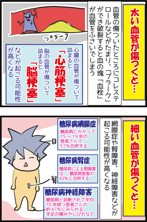 （今さらですが）なぜ血糖値が高いとダメなの？どうなるの…？3