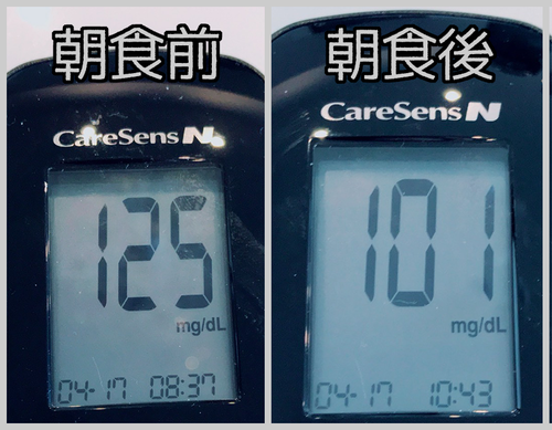 朝食前後血糖値
