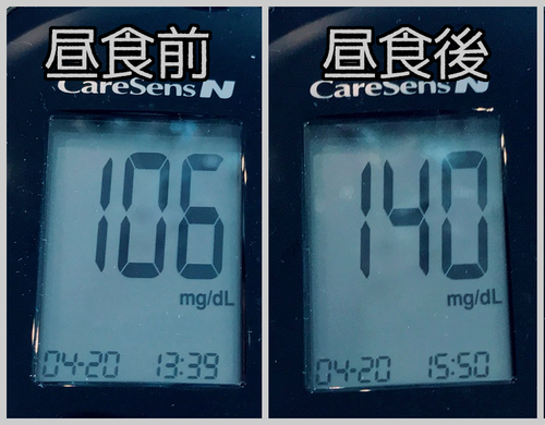 昼食前後血糖値