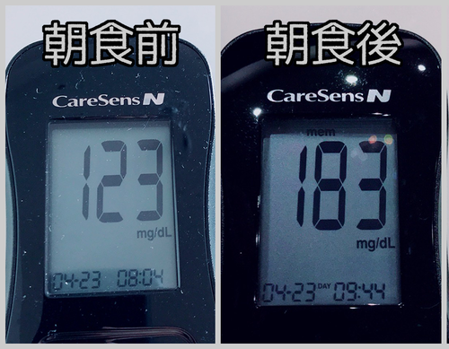 朝食前後血糖値