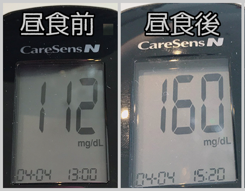 昼食前後血糖値