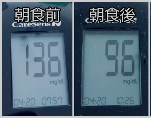 朝食前後血糖値