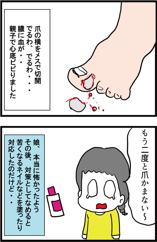娘が爪を10年間噛み続けた結果が・・5