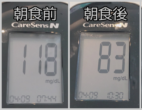 朝食前後血糖値