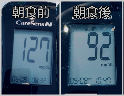 朝食前後血糖値