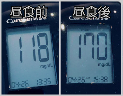 昼食前後血糖値