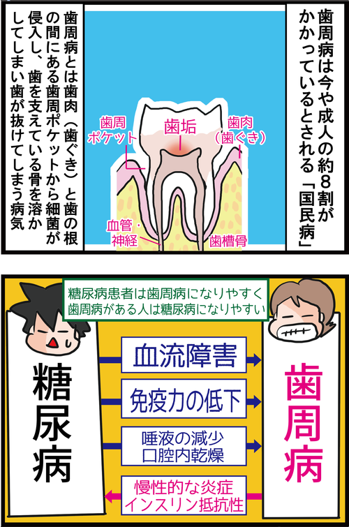 【血糖値】歯周病と糖尿病の意外な関係…3