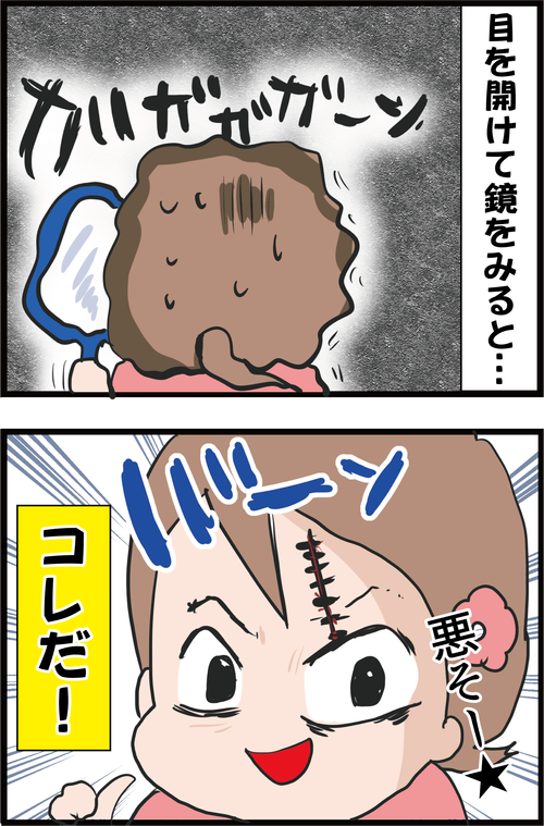 【血糖値】妻の顔に残る深い傷跡…そして夫の糖尿病は始まった…!2