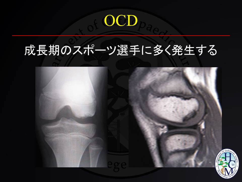 離断