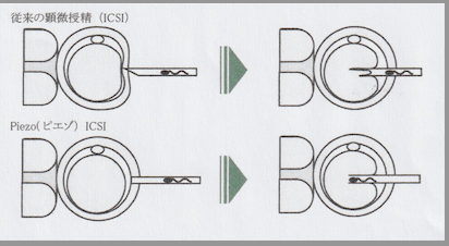 �����꡼�󥷥�å� 2023-04-16 15.34.32