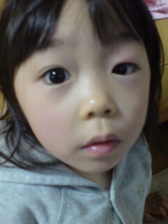 ものもらい 小春日和