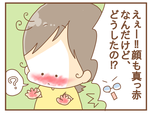 export