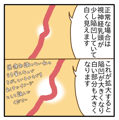 1000020017