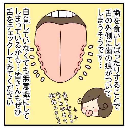 export