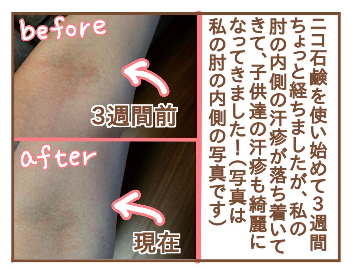 夏の汗疹など肌トラブル対策で敏感肌用石鹸を使ってみました モニター ひよっこ一家備忘録 Powered By ライブドアブログ