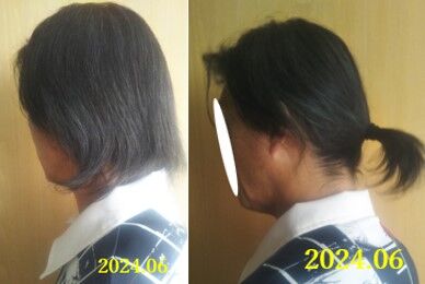 髪の毛202406X＆Y