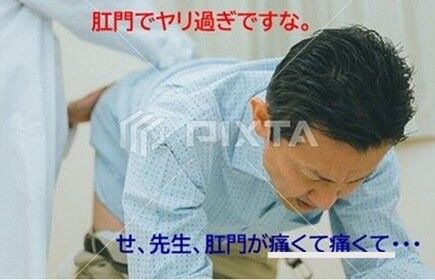 肛門でヤリ過ぎ