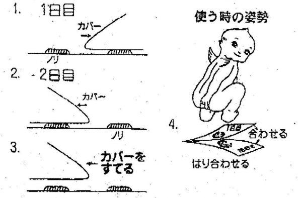 ぎょう虫検査方法