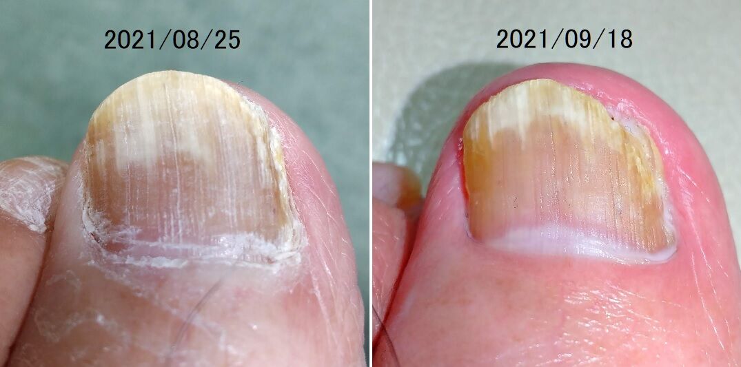 20210918-ゆーめ様