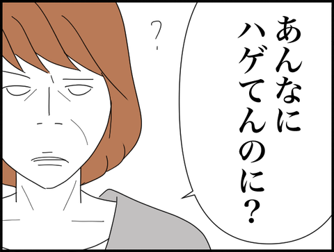 あんなにハゲてんのに？