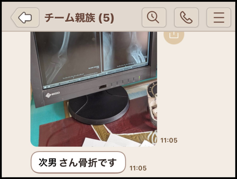 レントゲン写真