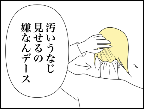 汚いうなじ見せたくないです