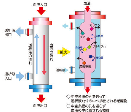 初めての透析 1 雨の日は雨を愛す 初めての透析 1 雨の日は雨を愛す