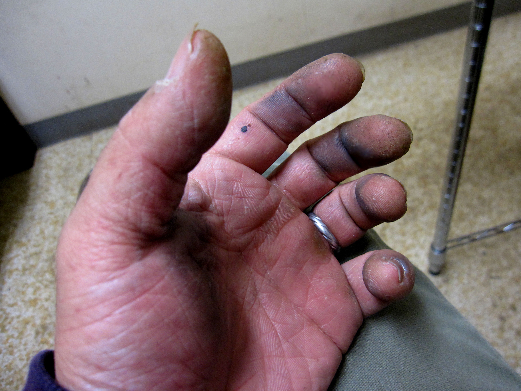 バラのトゲあと ほのちゃん日記