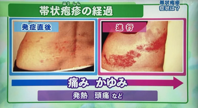 スクリーンショット 2023-08-10 19.43.43