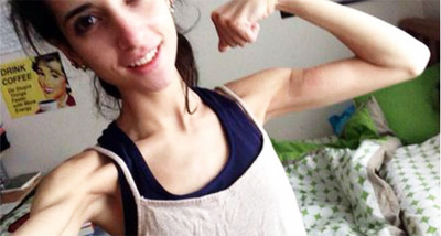 Sarah-Ramadan-anorexia-nervosa (1)