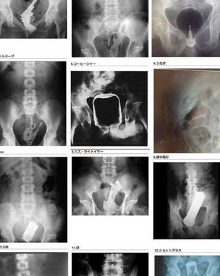 【警告】医師「みんなが知らない”肛門”の恐ろしい構造がこれ」” 24