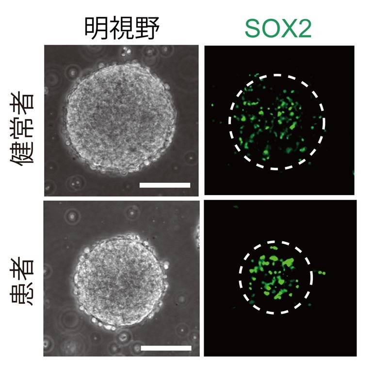 凹凸ちゃんねる