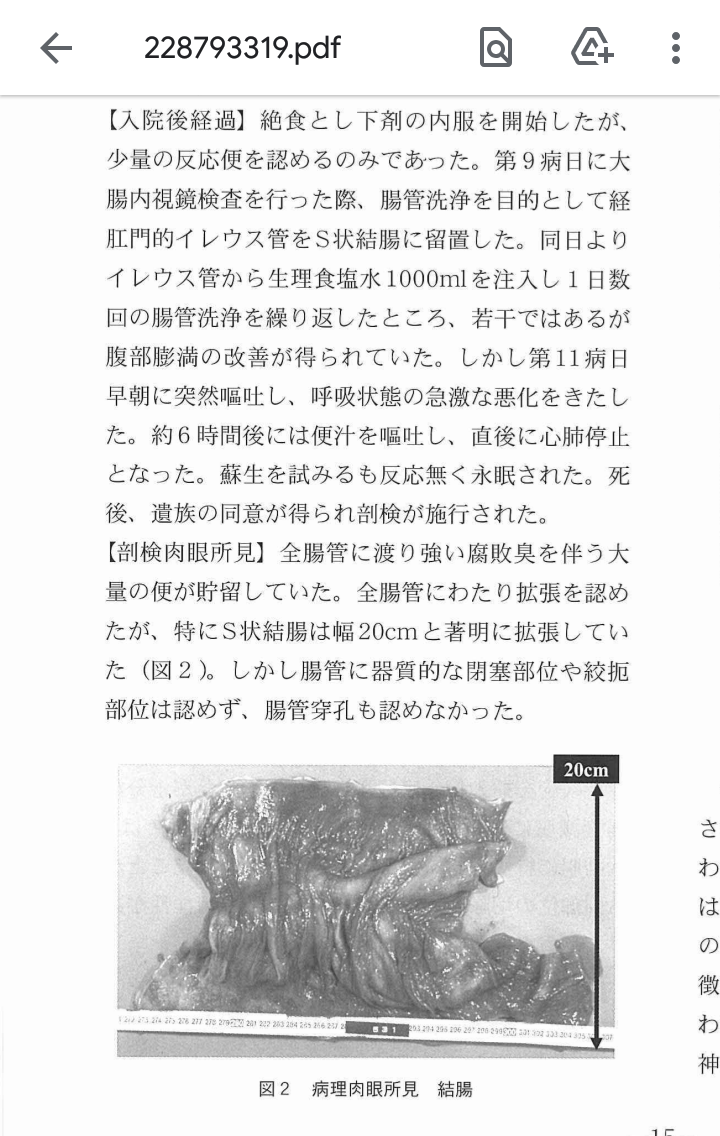 女の子 女子の便秘はエグいよ w キャッキャッ ワイ 2週間 女 え 凹凸ちゃんねる 発達障害 生きにくい人のまとめ 女の子 女子の便秘はエグいよ w キャッキャッ ワイ 2週間 女 え 凹凸ちゃんねる 発達障害 生きにくい人のまとめ
