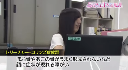 凹凸ちゃんねる