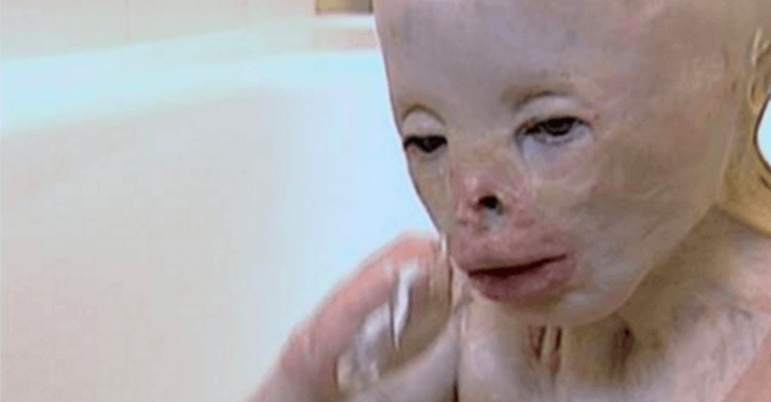 涙腺崩壊 養護施設で酷い仕打ちをされた少年が顔面崩壊 保護された時の彼の一言に涙腺崩壊